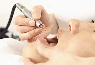 岐阜市則武・おやざと歯科・入れ歯（義歯）作製