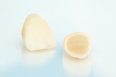 岐阜市則武・おやざと歯科・審美歯科