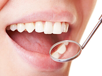 岐阜市則武・おやざと歯科・歯周病治療